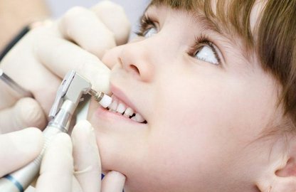 Роль іригатора у гігієні брекетів у підлітків