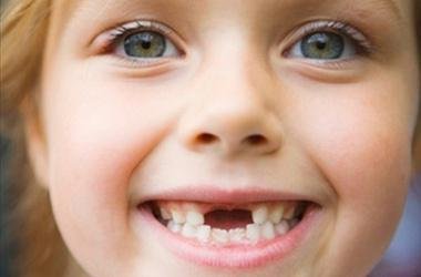 Вплив стану зубів на організм